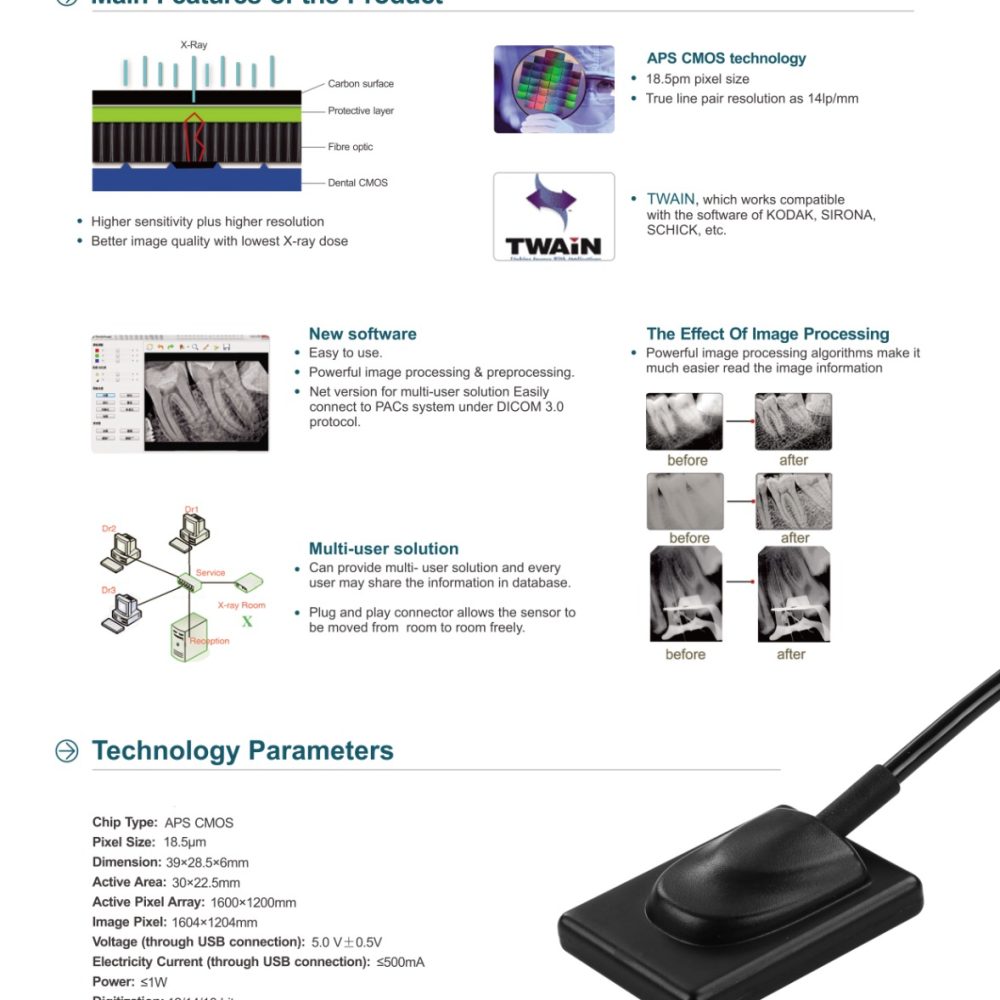 Alternative view of Sensore RVG intraorale LK-C62